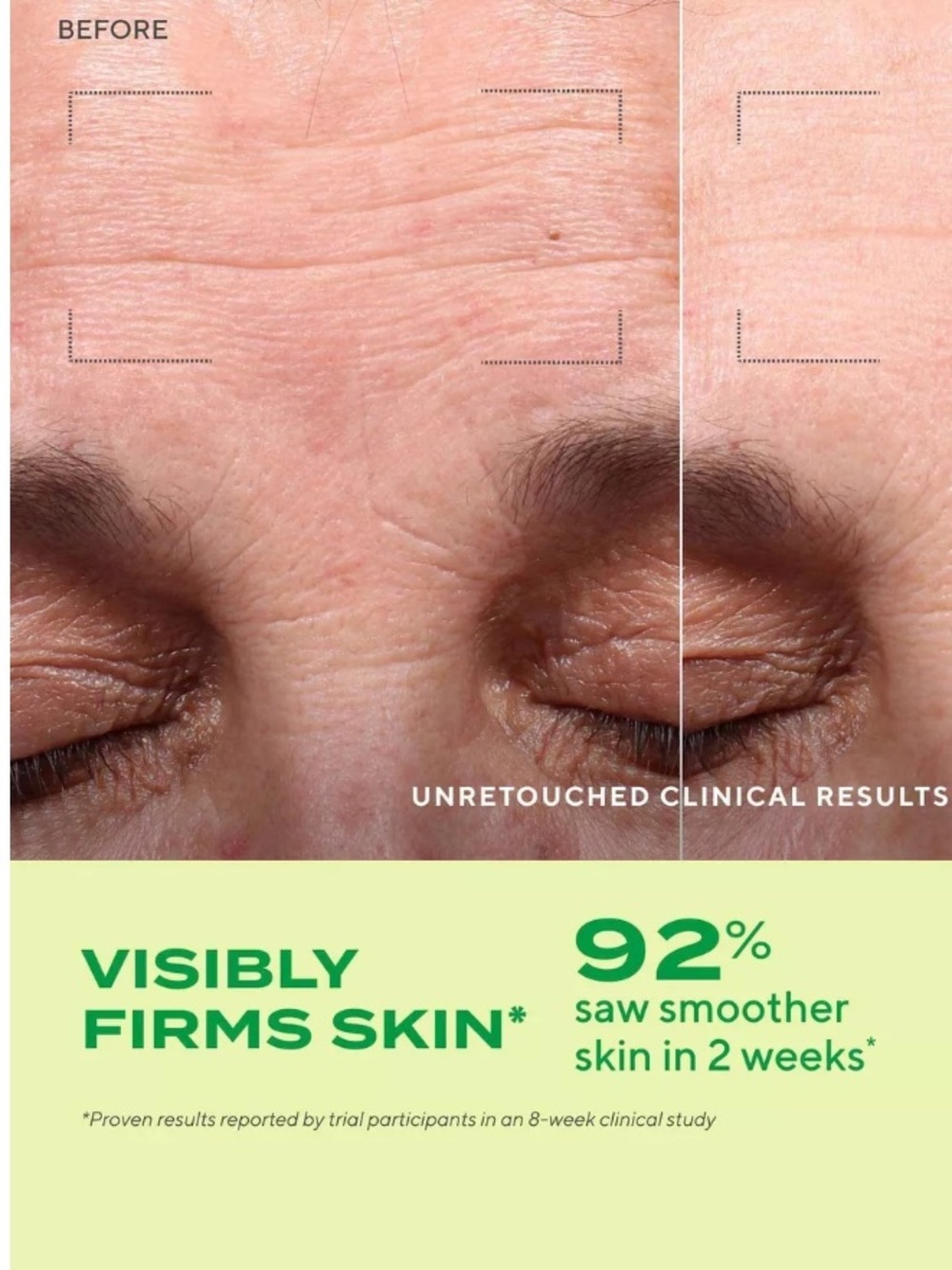 Murad Resurgence Retinol Youth Renewal Serum 92% results - Picture 7 of 10